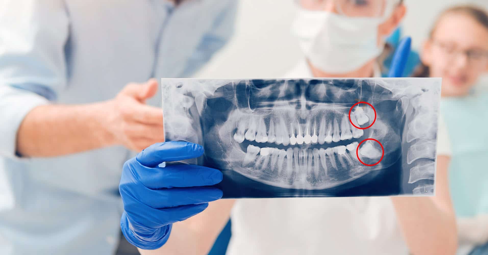 Say goodbye to wisdom teeth surgery with new treatment